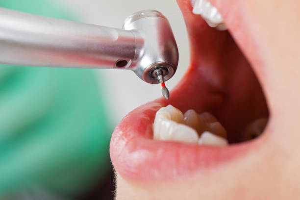 Best Tooth Infection Emergency Dentist  in Moundridge, KS